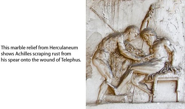 Hippocrates scraping rust from his spear onto Telephos' wound