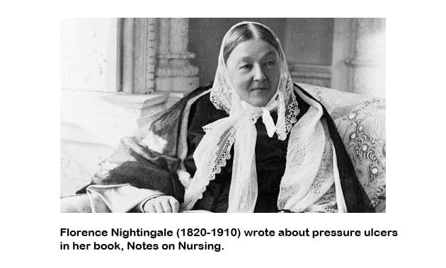 Florence Nightingale wrote on bedsores and pressure ulcers