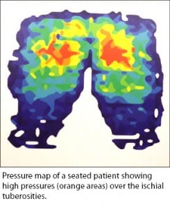 Wheelchair seat cushion options to reduce risks of pressure damage