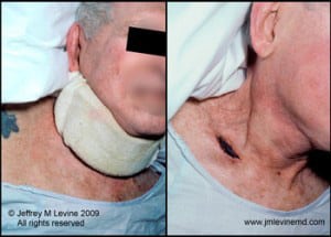Dr. Jeffrey Levine photographs wounds bedsores and pressure ulcers