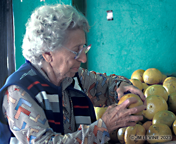 Nutrition and wound care nutrition, aging, gerontology, vitamins, wound healing, malnutrition, gray hair